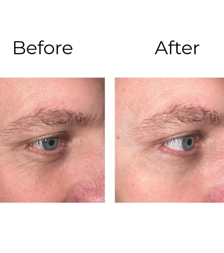 Crème anti-rides yeux « Shock Action » – Peptilux