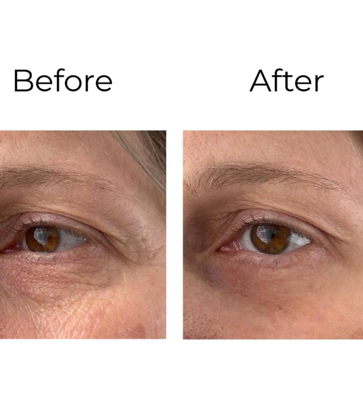 Crème anti-rides yeux « Shock Action » – Peptilux