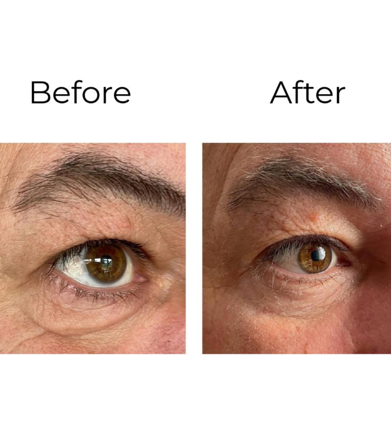 Crème anti-rides yeux « Shock Action » – Peptilux